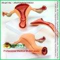 VENDER 12442 Estructura uterina Anatomical Model Anatomy Reproductive System